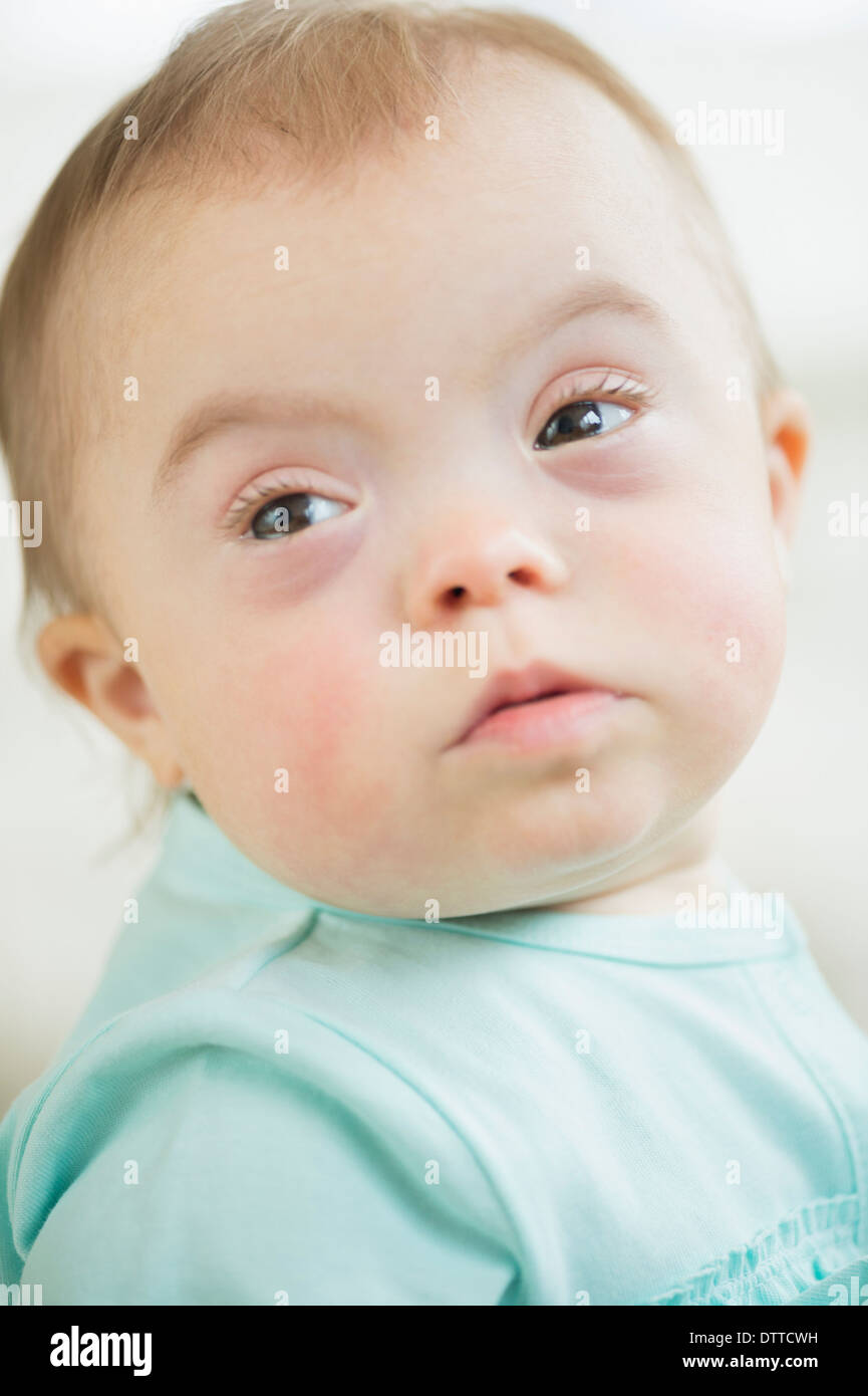 Kaukasische Mädchen mit Down-Syndrom Stockfoto