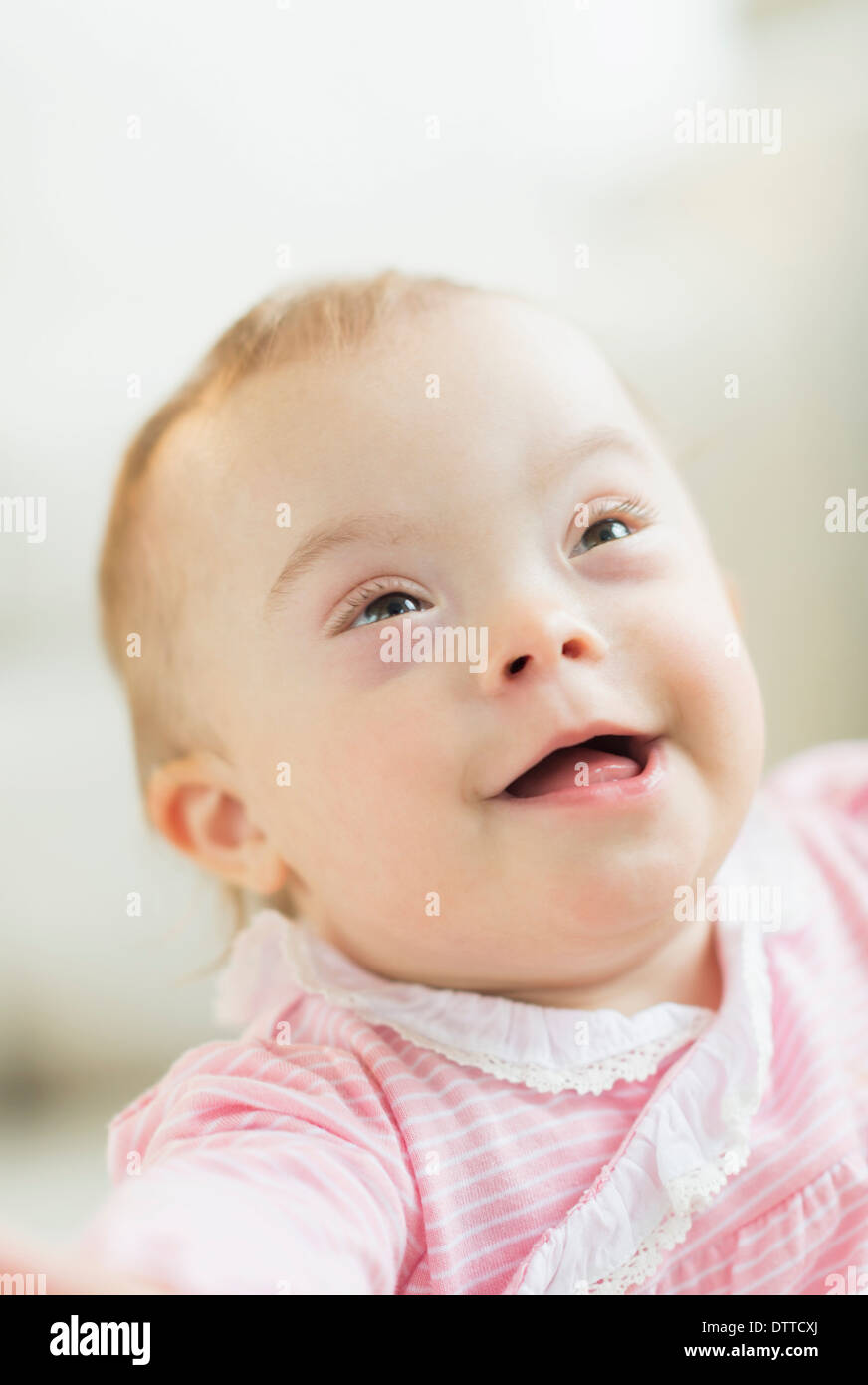 Kaukasische Mädchen mit Down-Syndrom Stockfoto