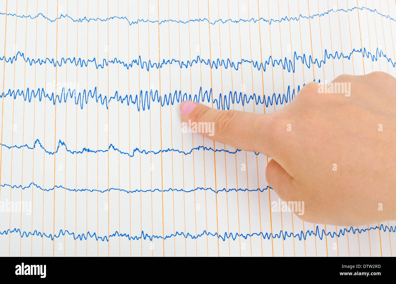 Arzt-Hand und EKG Stockfoto