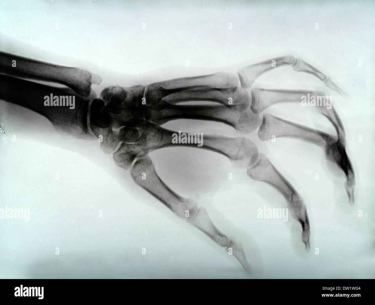 Hand-xray Stockfoto