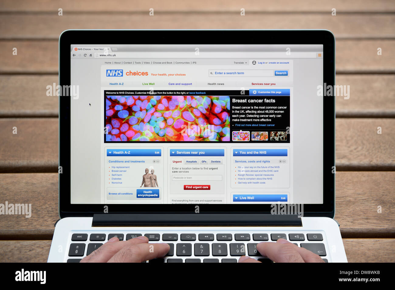 Die NHS-Entscheidungen-Website auf einem MacBook Hintergrund eine Holzbank im Freien einschließlich eines Mannes Finger (nur zur redaktionellen Verwendung). Stockfoto