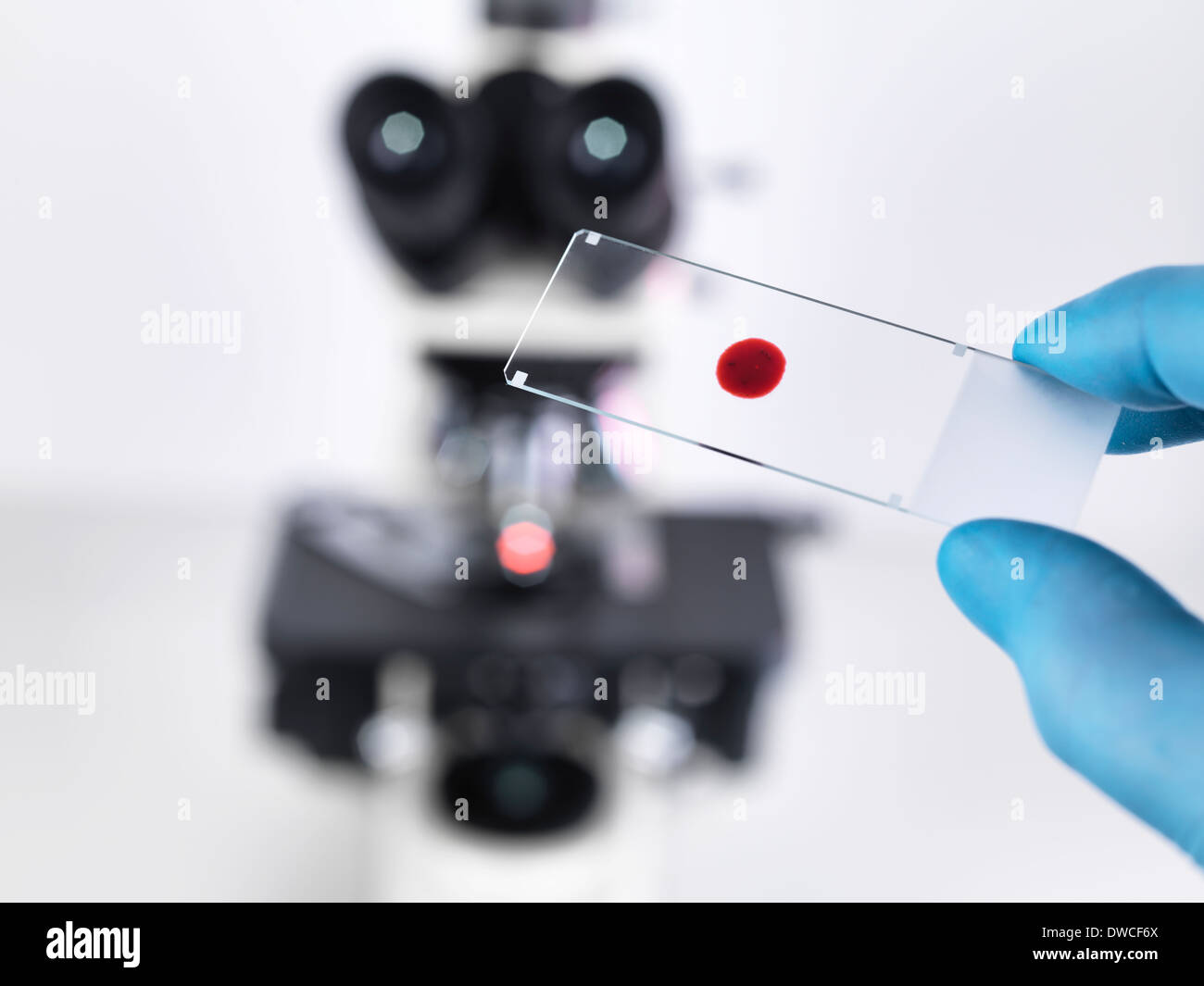 Labor Wissenschaftler halten eine Folie mit einer Blutprobe mit einem aufrechten Verbindung Mikroskop im Hintergrund Stockfoto