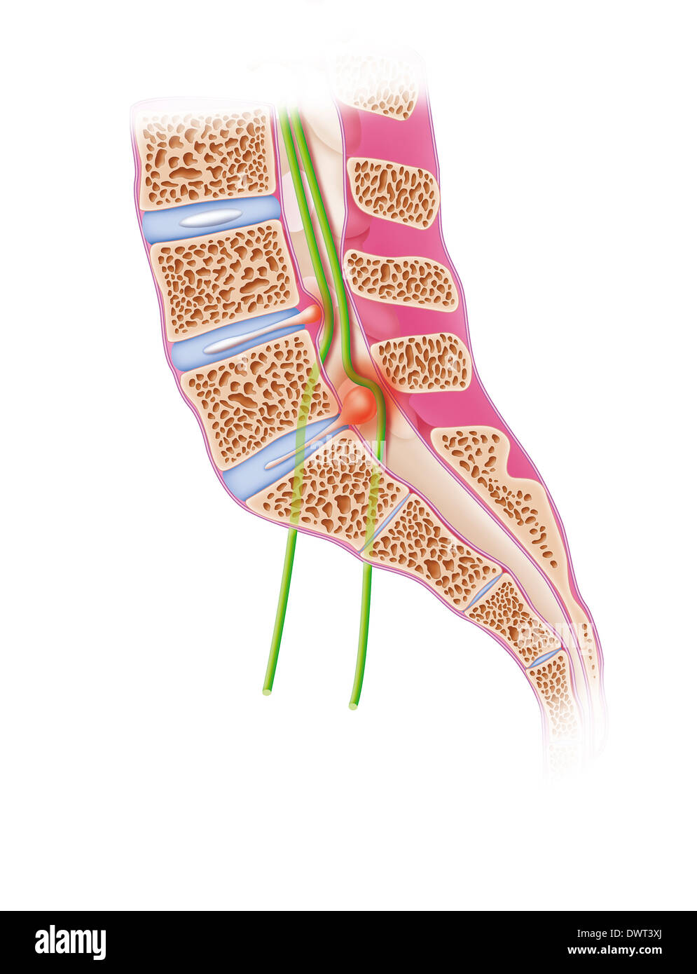 Ischias, Zeichnung Stockfoto