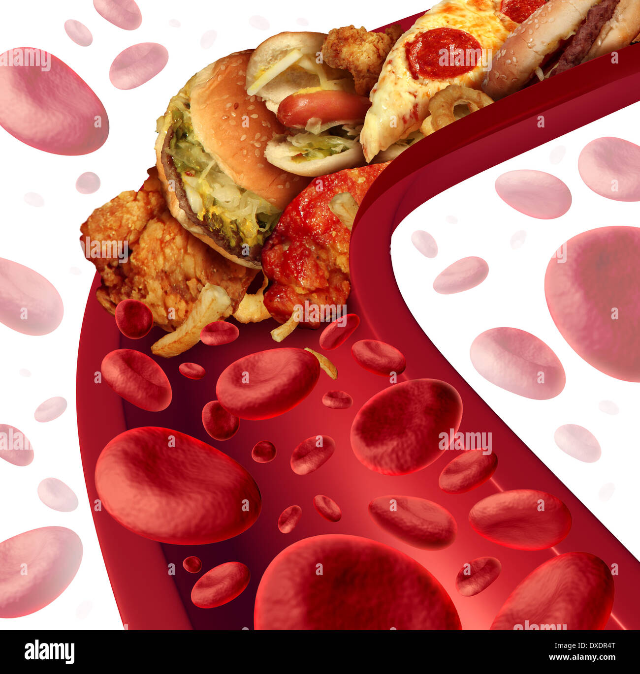 Cholesterin verstopften Arterie medizinisches Konzept mit einem menschlichen Blutgefäß, das durch ungesunde Lebensmittel wie Hamburger und frittierten Lebensmitteln als Gesundheit Risiko Metapher für Diät und Ernährung Probleme wie Essen Fett verstopft ist. Stockfoto