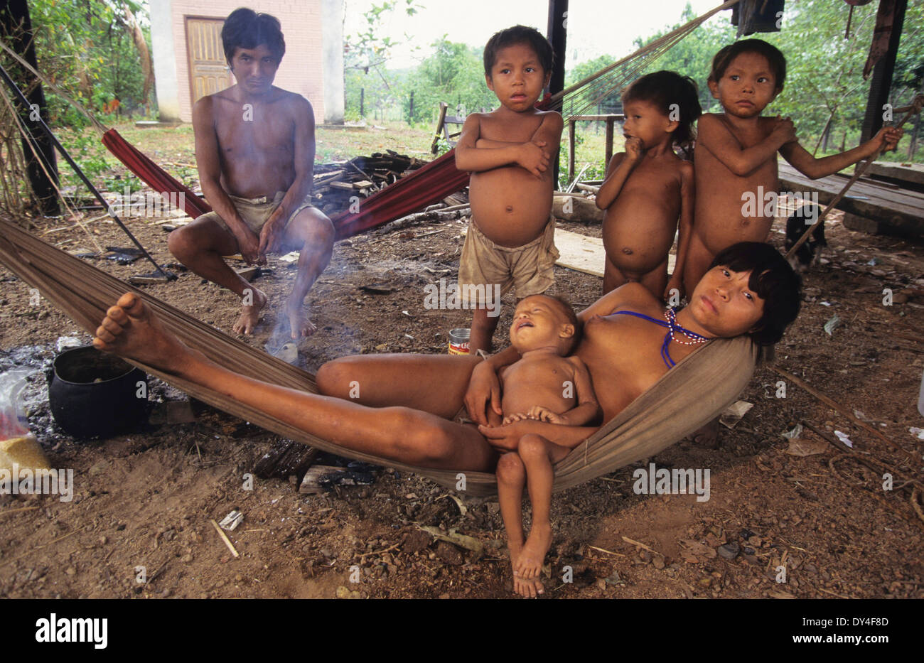 Malaria-Opfer leiden. Kind leidet an Malaria, Yanomami-Familie. Boa Vista, Roraima Provinz, Brasilien, Südamerika Stockfoto