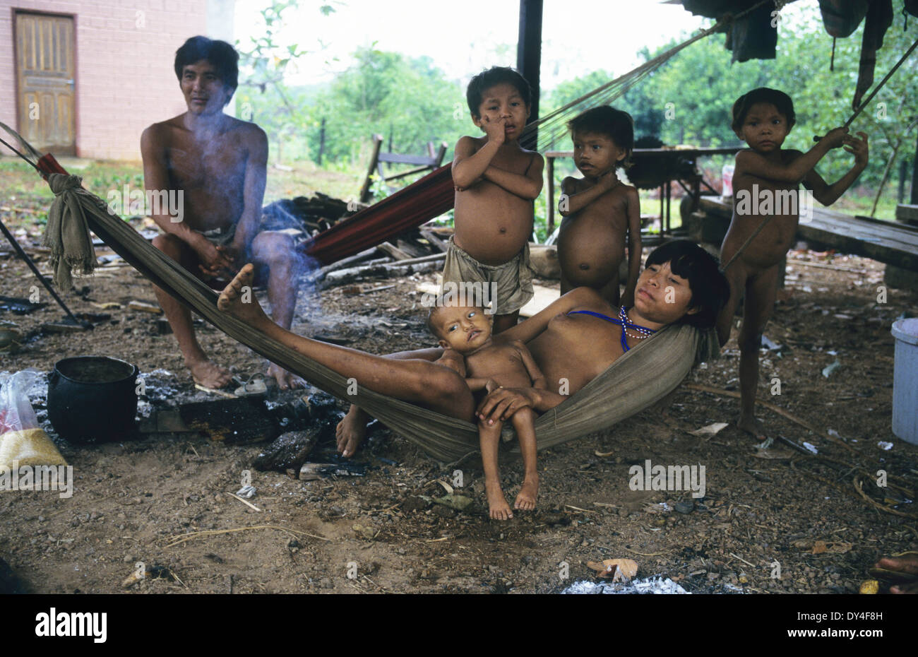 Malaria-Opfer leiden. Kind leidet an Malaria, Yanomami-Familie. Boa Vista, Roraima Provinz, Brasilien, Südamerika Stockfoto