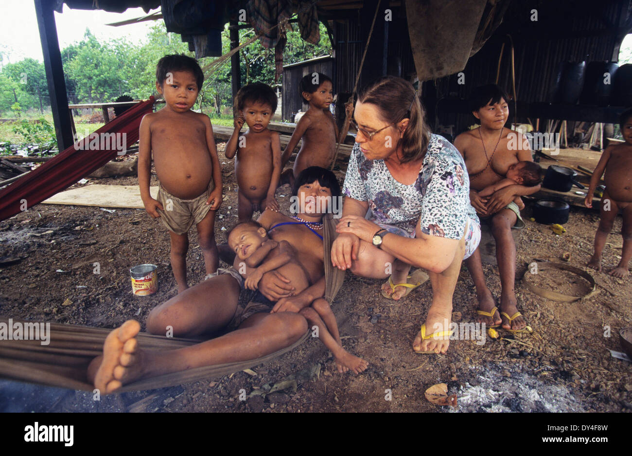 Malaria-Opfer leiden. Kind leidet an Malaria, Yanomami-Familie. Boa Vista, Roraima Provinz, Brasilien, Südamerika Stockfoto