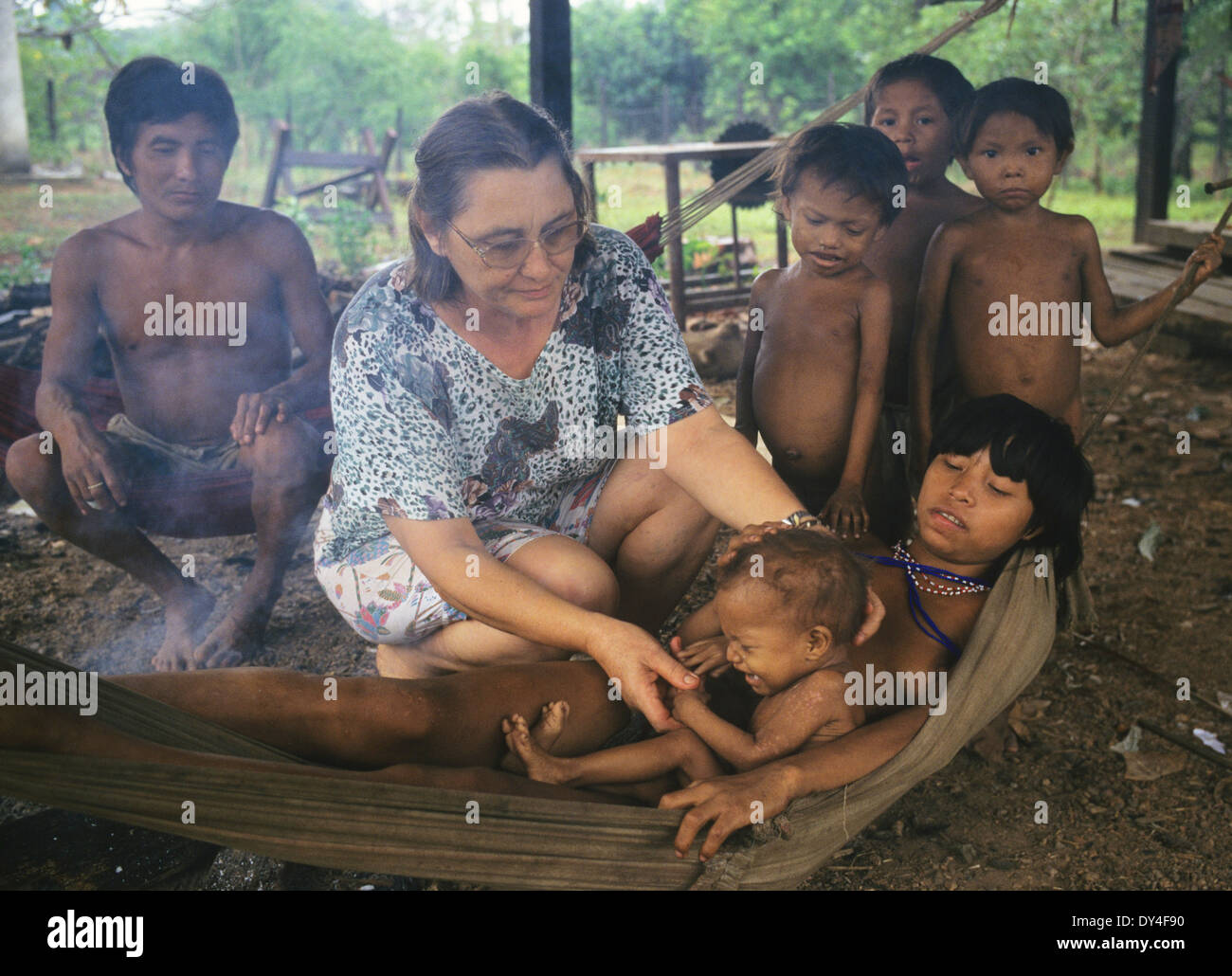 Malaria-Opfer leiden. Kind leidet an Malaria, Yanomami-Familie. Boa Vista, Roraima Provinz, Brasilien, Südamerika Stockfoto