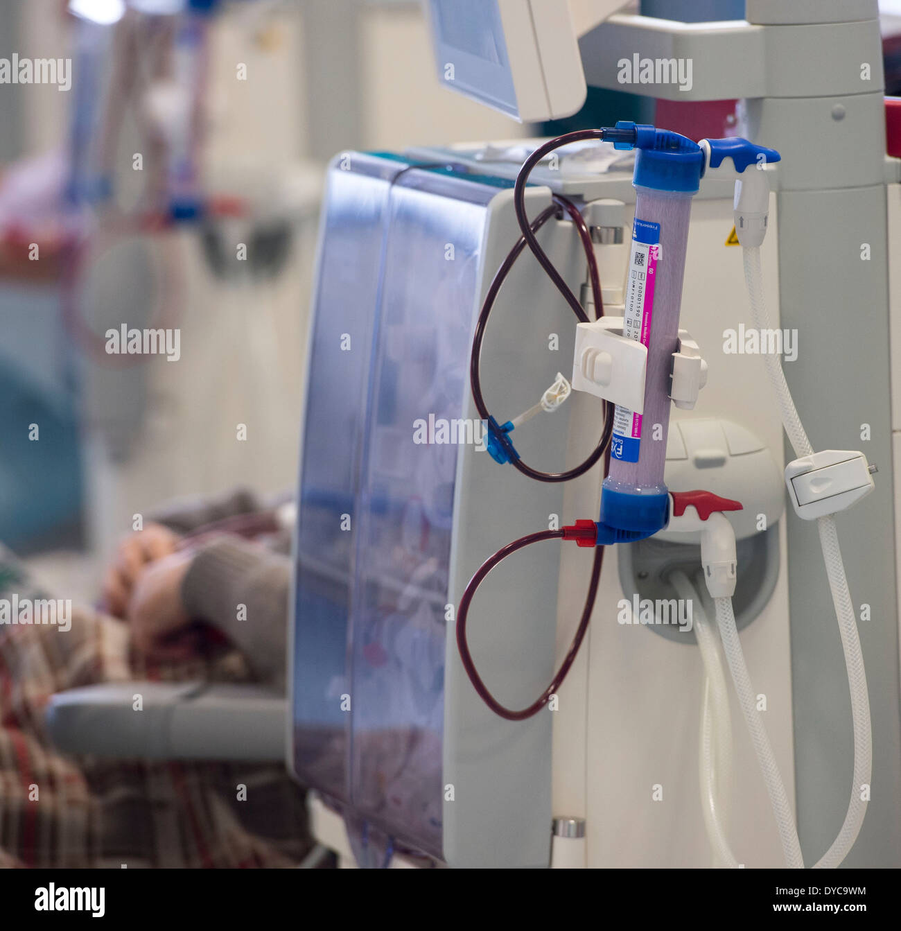 Eine Niere Dialysepatient erhält Behandlung von Nierenversagen in einem NHS Krankenhaus. Stockfoto