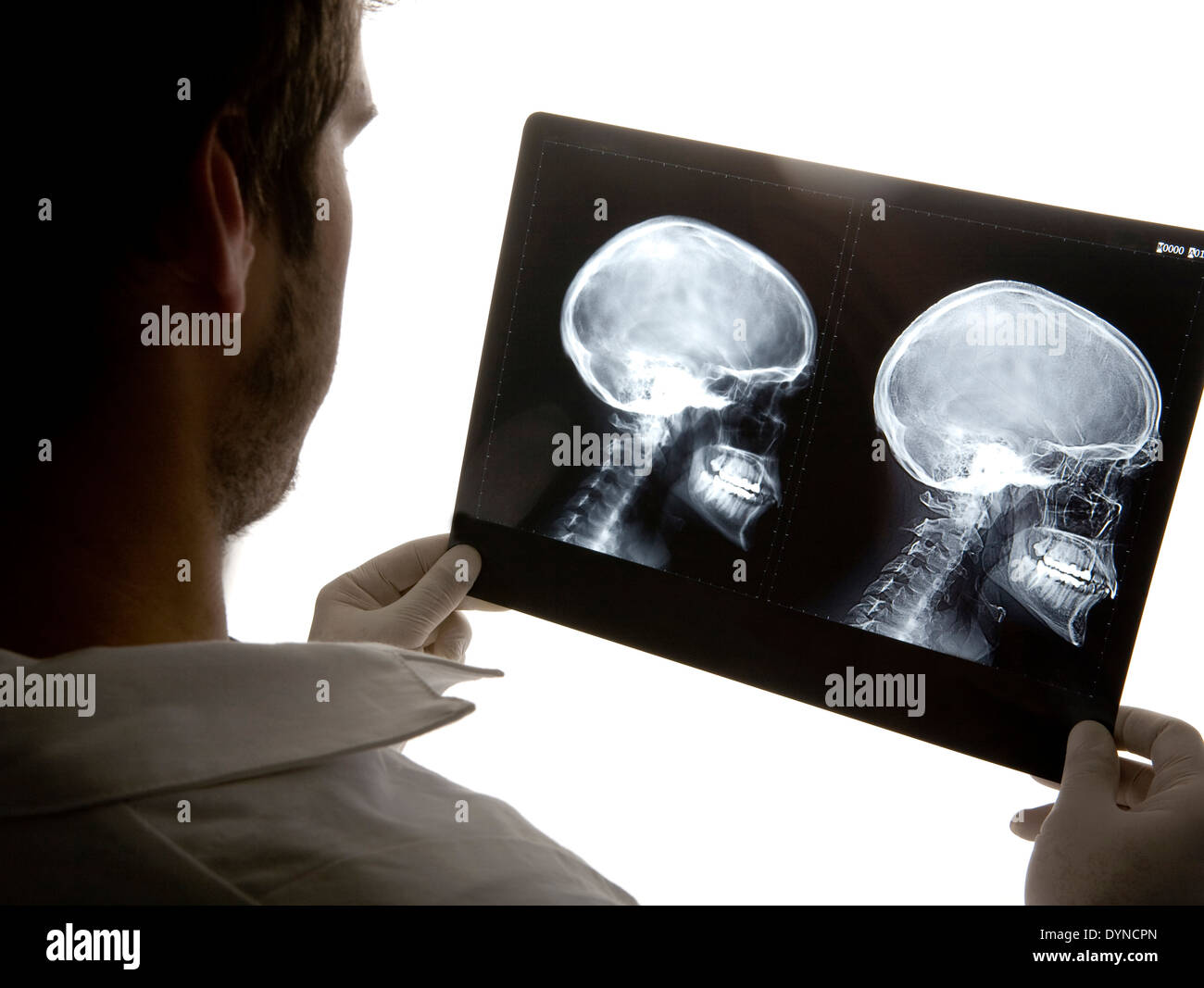 Kaukasische Arzt Röntgenaufnahmen im Krankenhaus untersuchen Stockfoto