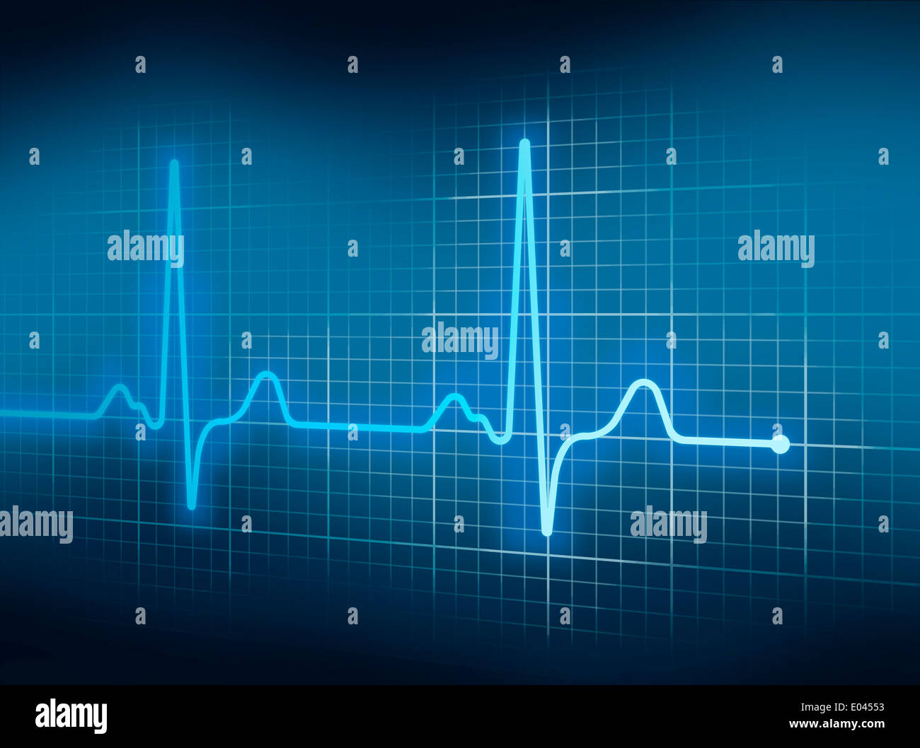 Blaue Elektrokardiographie Herzschlag Puls auf Graph. Stockfoto