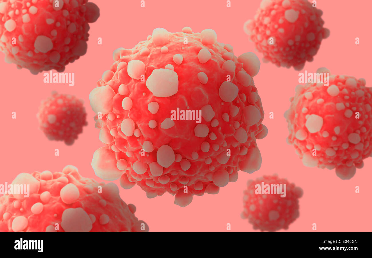 Microscipic Ansicht der pankreatischen Krebszellen. Stockfoto