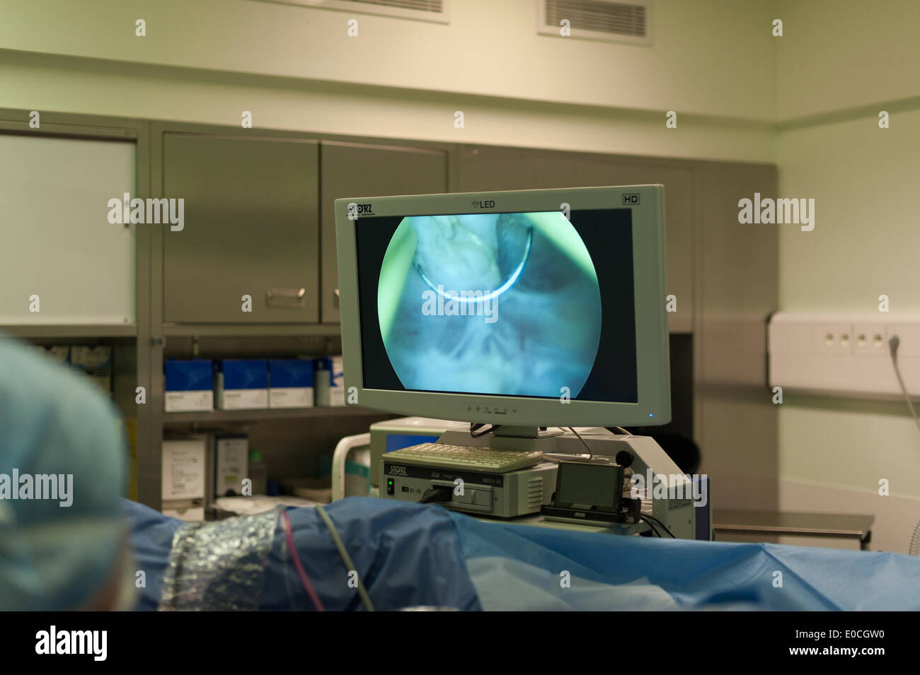 Krankenhausoperation Zum Des Myoms Zu Entfernen Fotos Und Bildmaterial In Hoher Auflösung Alamy 