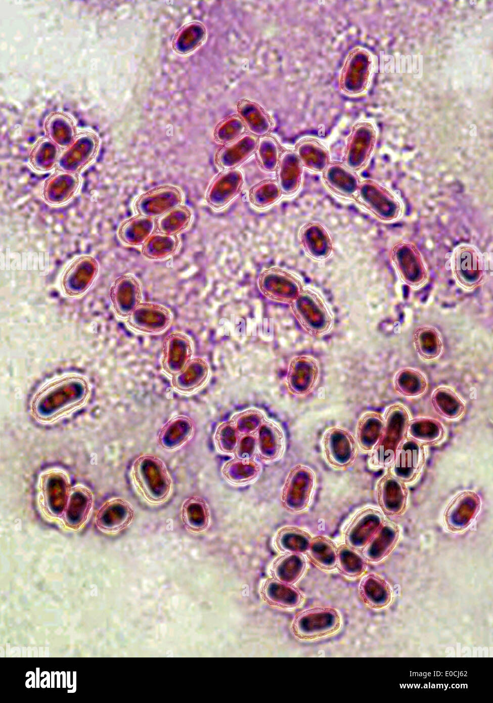 Streptococcus pneumoniae Stockfoto