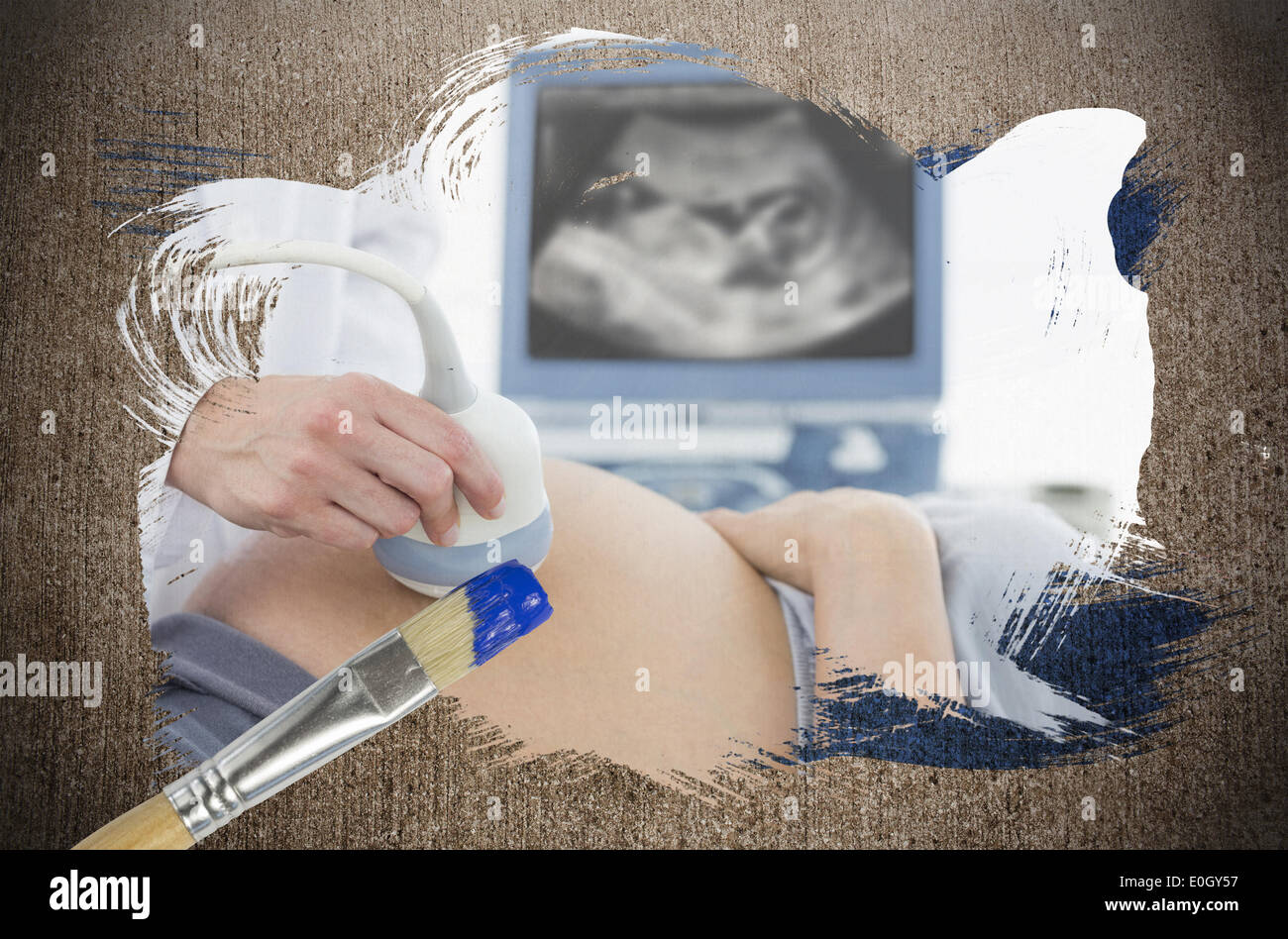 Zusammengesetztes Bild der schwangeren Frau, die immer einer Ultraschalluntersuchung Stockfoto