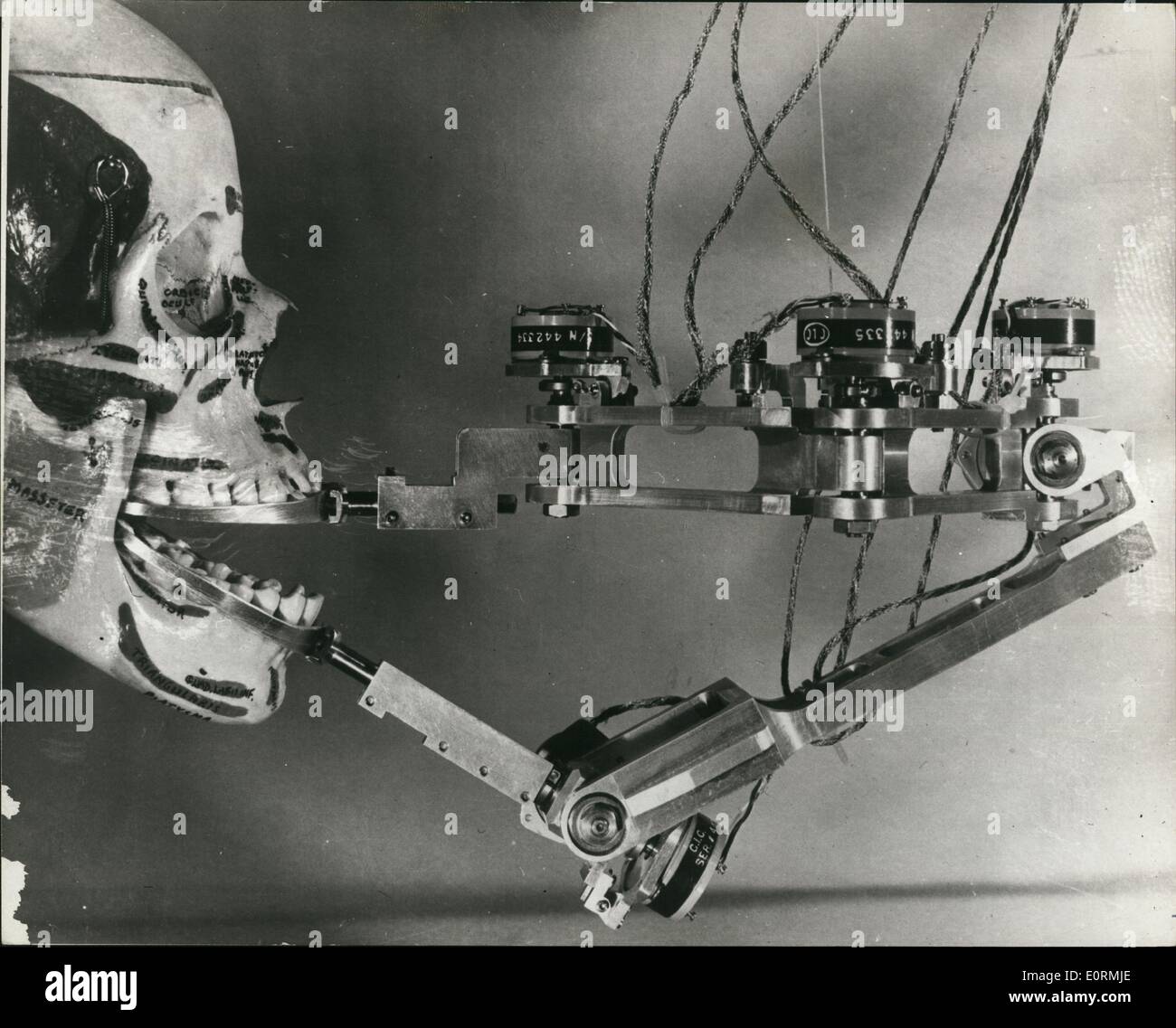 1. Januar 1960 - revolutionäre neue elektronische Kiefer Messung Gerät entwickelt: Die komplizierten Bewegungen des menschlichen Kiefers, lange dunkle dental Forscher nun mit Leichtigkeit und Genauigkeit durch dieses kleine, leichte Gerät analysiert werden können. Die Kiefer-Bewegung-Messgerät besteht aus Aluminium gebaut. Es misst die sechs Winkel der Kieferbewegungen in Zoll und Grad der Drehung mit hoher Genauigkeit und liefert elektrische Signale, die direkt an einen Computer gekoppelt werden können. Entwickelt von George S Stockfoto