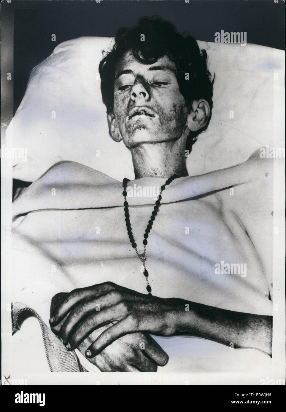 06. Jun 1963 - ''Human Skeleton'' Fast Shot: Sidney Dale hat 28 Tage verloren im australischen Outback überlebt und endet damit, dass er fast erschossen wurde. Alles begann, als sein Pferd von der Elizabeth Downs Mustering Station im  Territory b, nachdem er von einem Stier erschrocken wurde. Durch den  gewann er die Kontrolle über sein Pferd, er war verloren, ohne  Gewehrspiele, Messer oder Stiefel, und für drei Tage  Wandern auf der Suche nach Nahrung oder Wasser, dann sein Pferd wurde wieder Angst dieses Mal von einem wilden Büffel Stockfoto