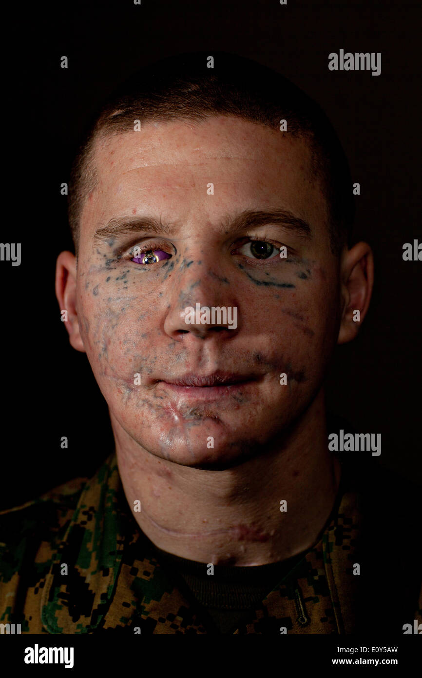 US Marine LCpl Kyle Carpenter Porträt im Laufe der ersten Korporale für verwundete Krieger am Walter Reed National Military Medical Center 12. Januar 2012 in Bethesda, Maryland. Tischler erlitten Wunden eine feindliche Granate in Mardscha, Afghanistan werden Medal Of Honor für auffällige Galanterie von Präsident Barack Obama im Weißen Haus Zeremonie am 19. Juni 2014 verliehen. Stockfoto