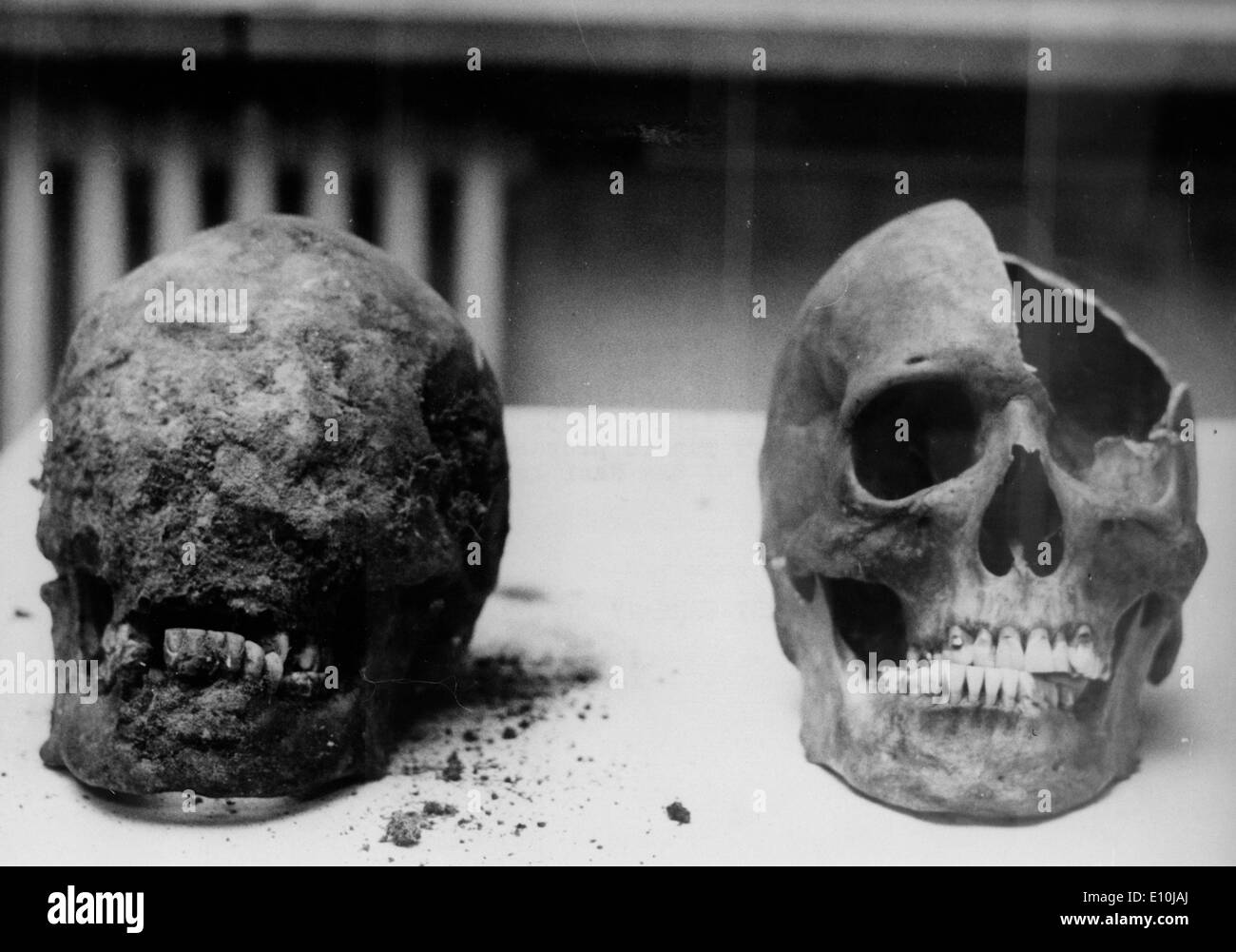 Zwei Knochen, einen Schädel und Oberschenkel, wurden bei Ausgrabungen in Berlins Lehrt Station gefunden. Stockfoto