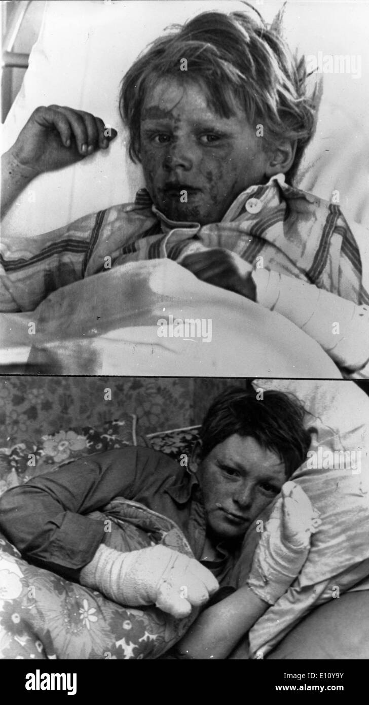 Zwei katholischen jungen, BERNARD LYNCH und JAMES CRAWFORD nach wird von evangelischen Jugendlichen in Brand gesetzt. Stockfoto