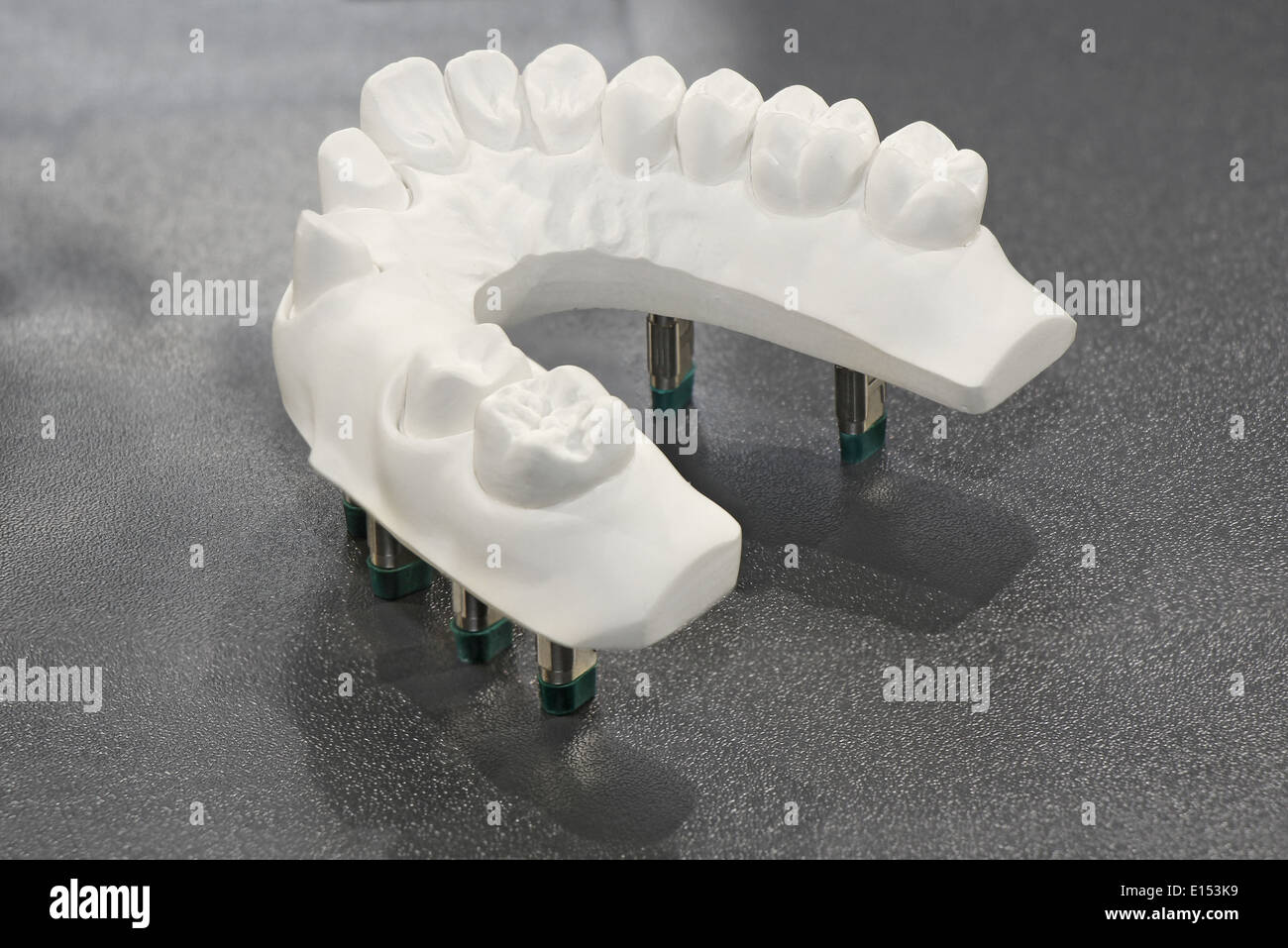 Dental Gießen Gips Gips Modell der Zähne Stockfoto