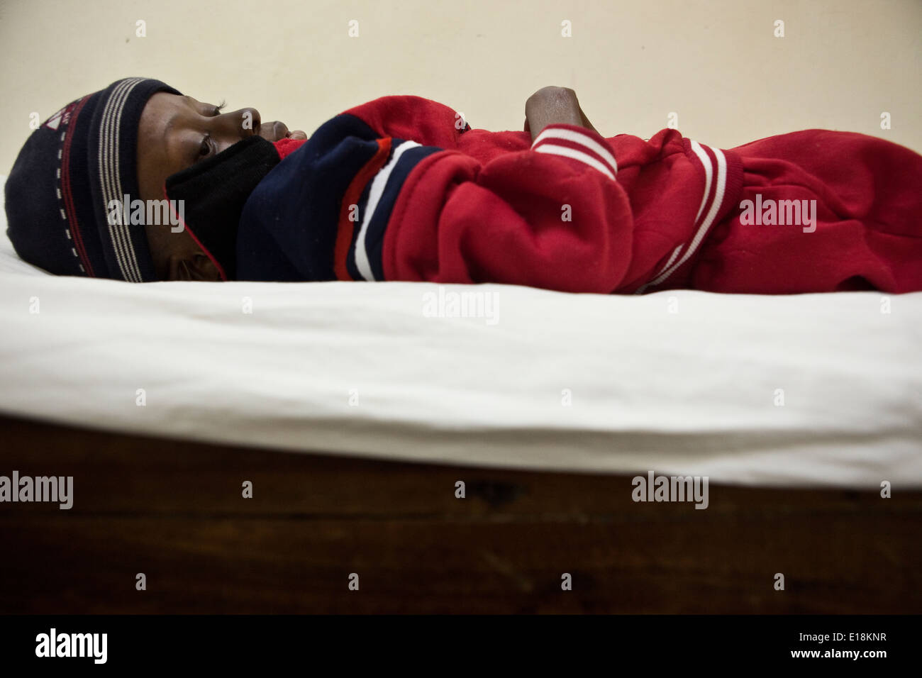 Ein Kind leidet an HIV / AIDS in einem Krankenhaus in Moshi, Tansania, Ostafrika. Stockfoto