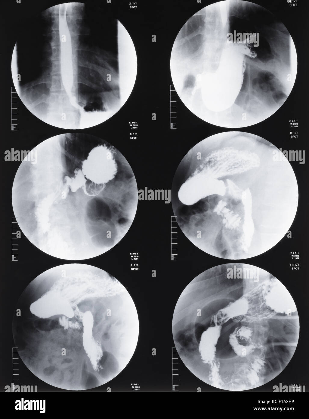 Magnet-Resonanz-Tomographie des Magens und des Darms Stockfoto