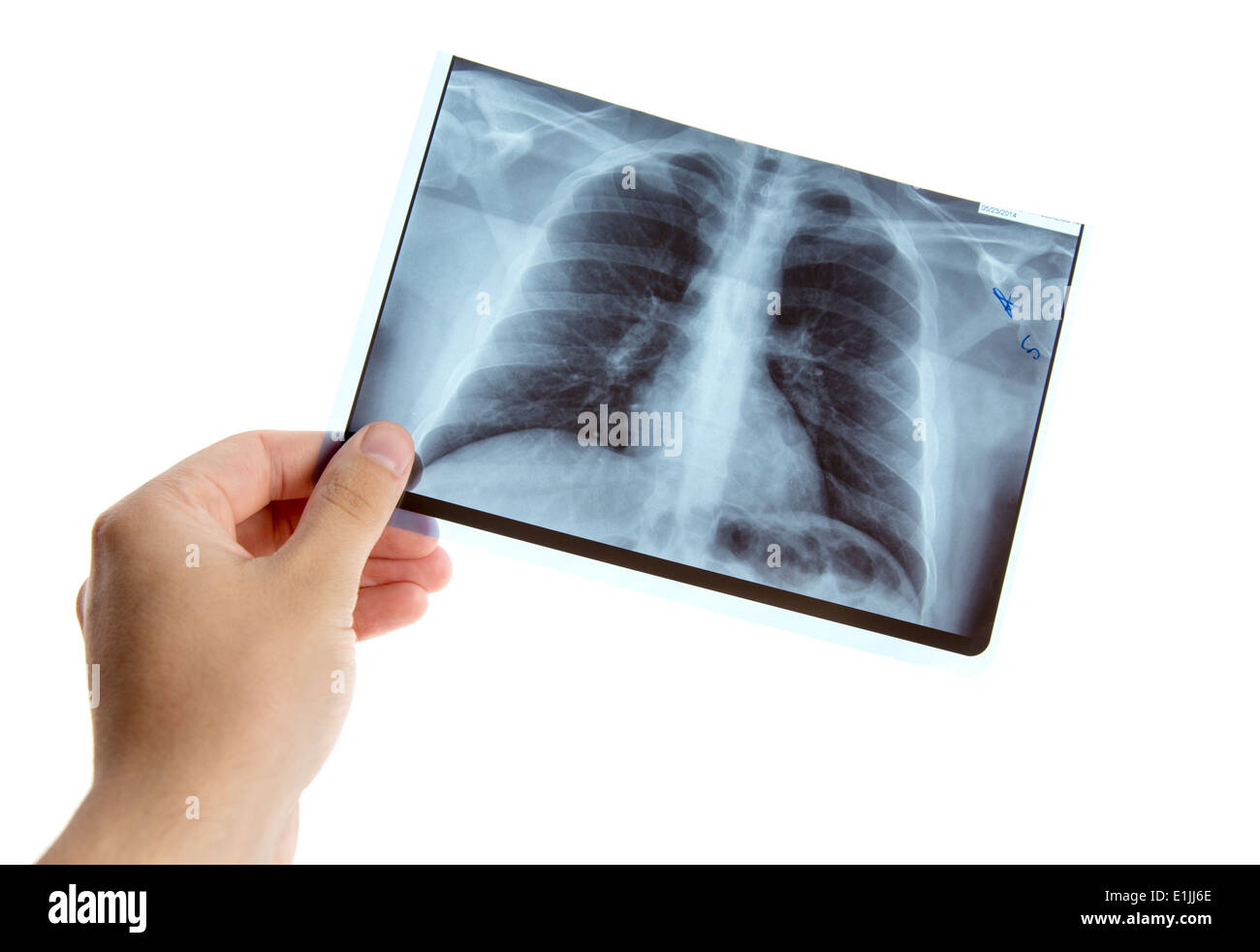 Männliche Hand, die Lunge Röntgen, isoliert auf weißem Hintergrund Stockfoto