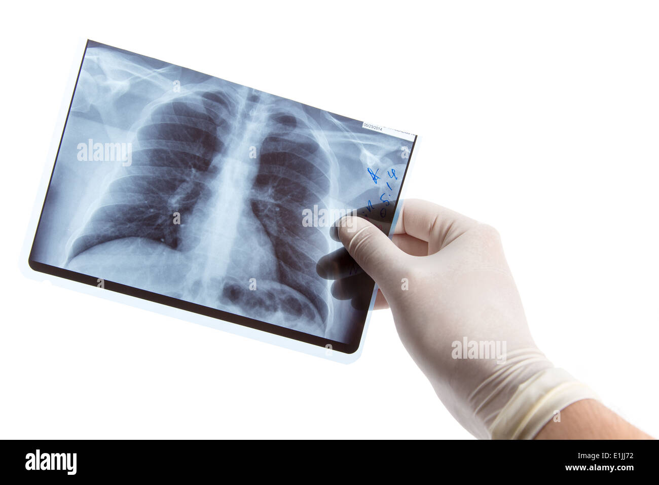 Männliche Hand in medizinische Handschuhe halten Lunge Röntgen, isoliert auf weißem Hintergrund Stockfoto