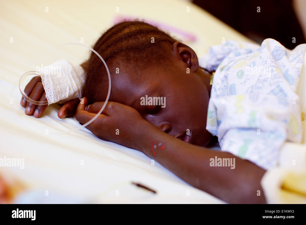 Kamissa, ein afrikanischen Kind mit eine kardiale Fehlbildung von Surgeons of Hope in einem Krankenhaus in Paris betreut Stockfoto