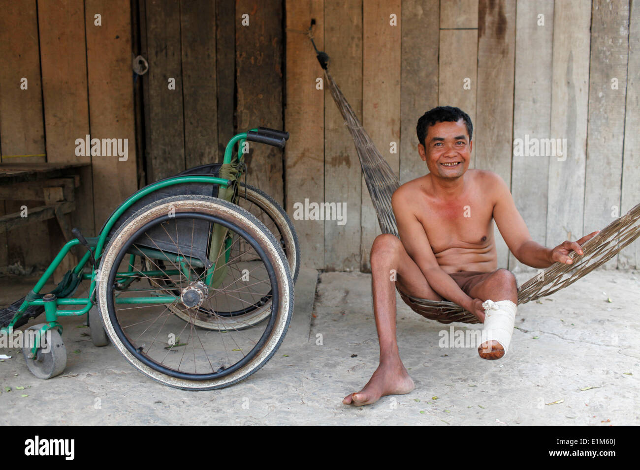 Crippled Stockfotos und bilder Kaufen Alamy