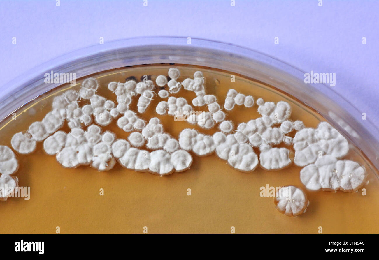 Bakterienkolonien auf festem Medium in einer Petrischale. Entdeckung von Medikamenten. Biotechnologie-Forschungslabor. Stockfoto