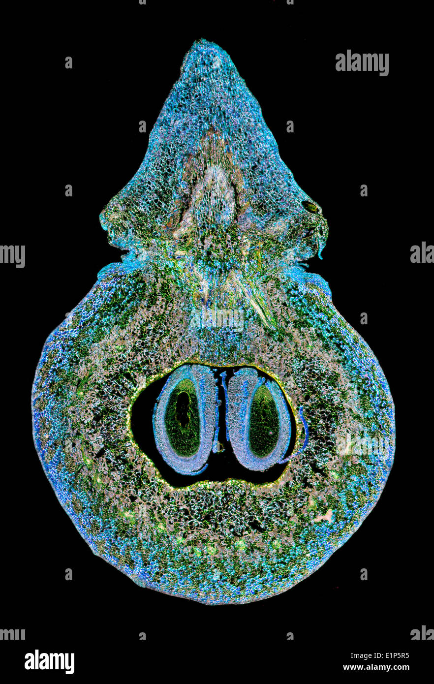 Vitis Vinifera (gemeinsame Weinrebe) frühen Knospe zeigt zentrale Samen, Dunkelfeld Mikrophotographie, befleckt Abschnitt Stockfoto