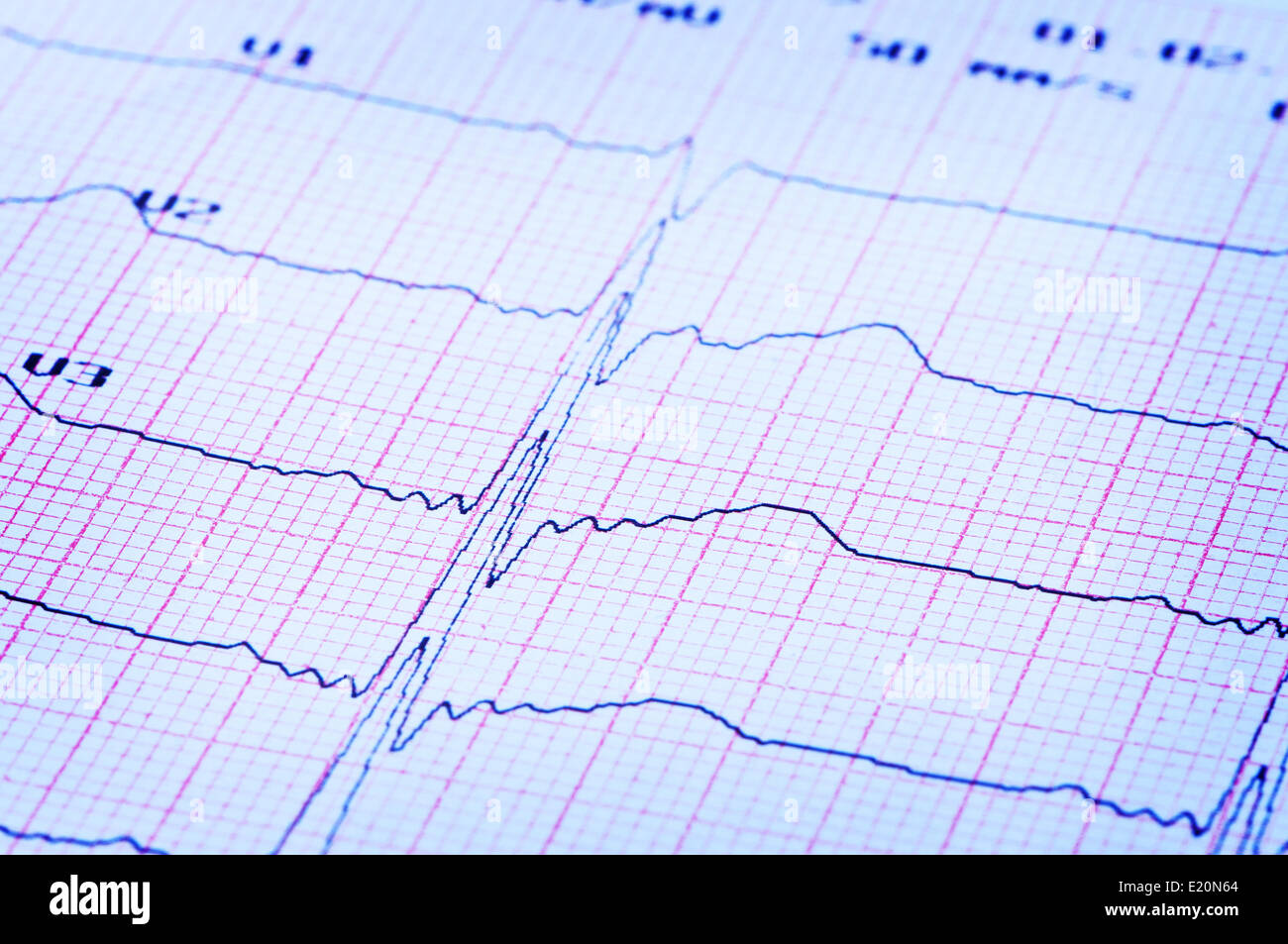 EKG des Herzens auf dem Papier. Stockfoto