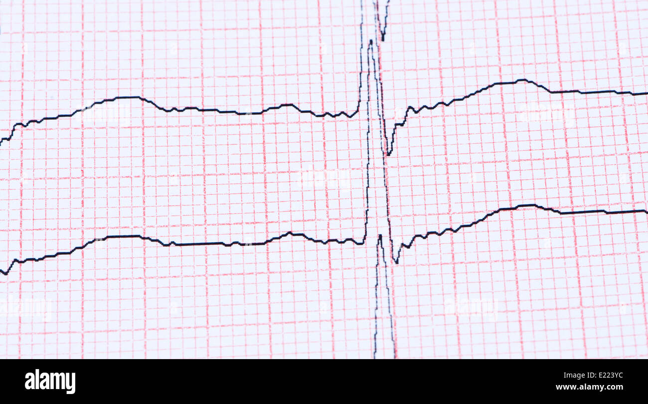 EKG auf Papier. Stockfoto