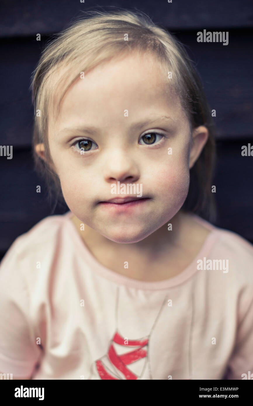 Nachdenklich Mädchen mit Down-Syndrom wegschauen Stockfoto