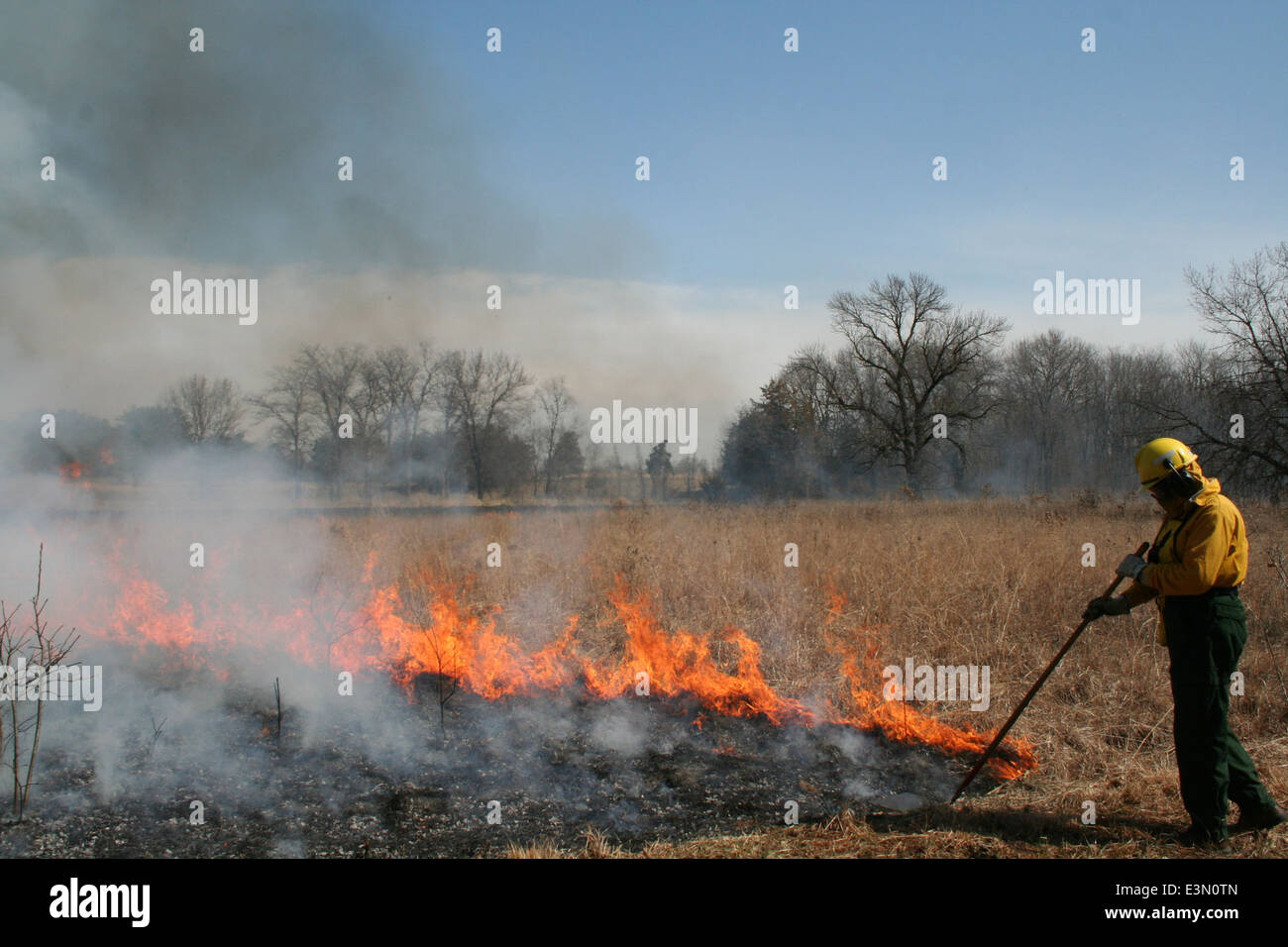 Vorgeschriebenen Burn Stockfoto