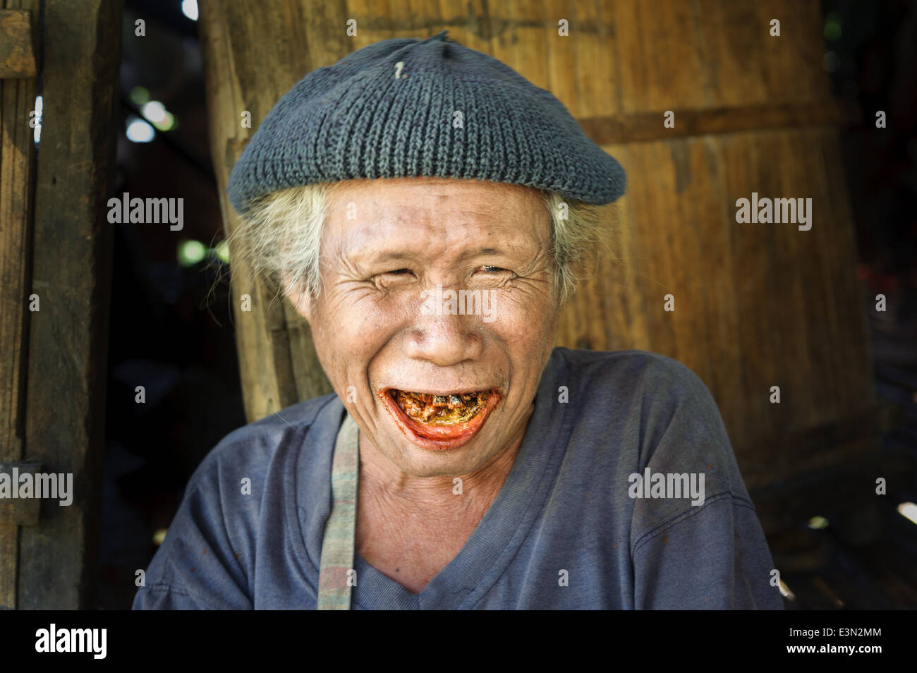 Mann faule zähne -Fotos und -Bildmaterial in hoher Auflösung – Alamy