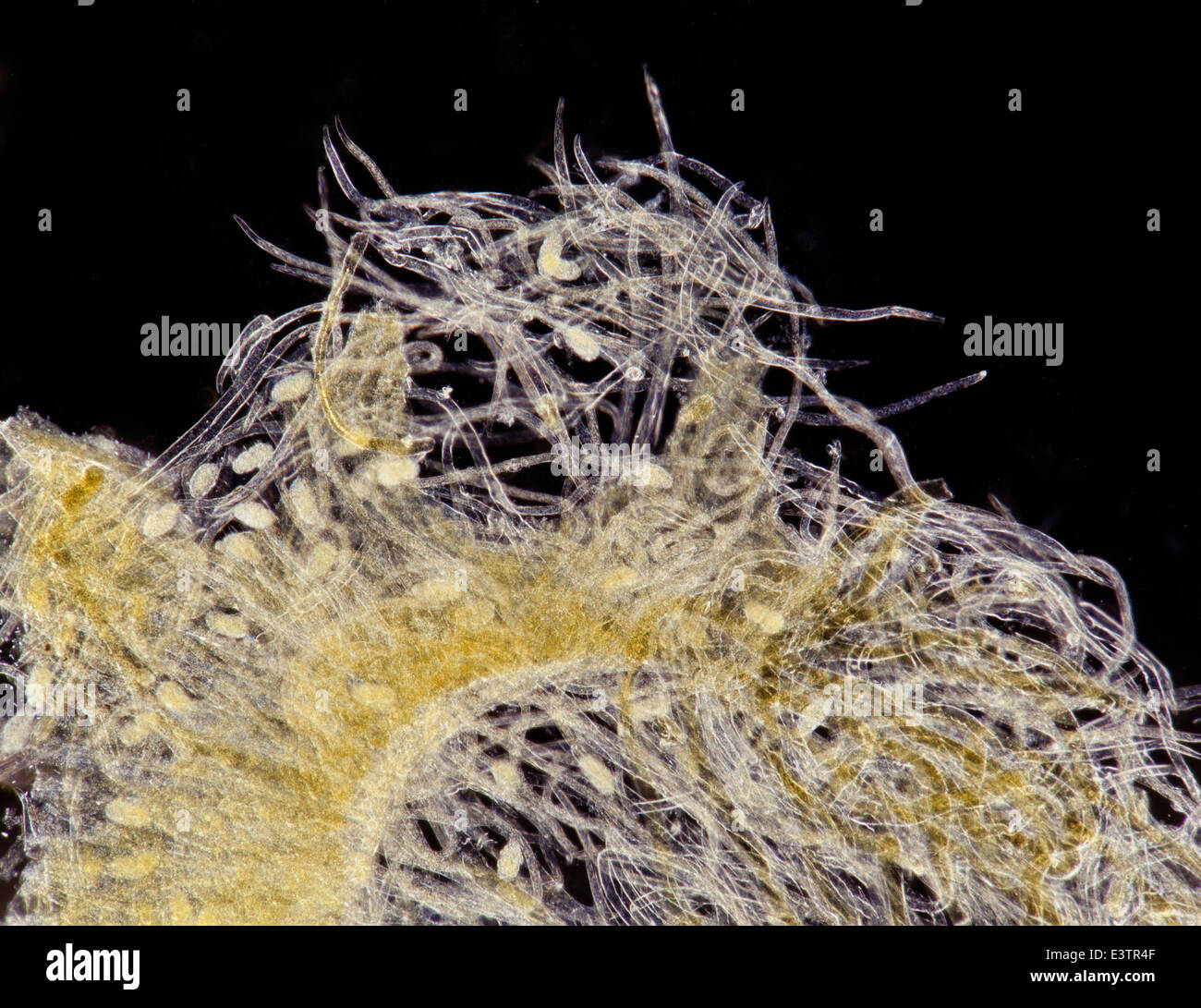 Dunkelfeld Mikrophotographie, Würmer Thread Filaria sp von bescheidenen Biene Stockfoto