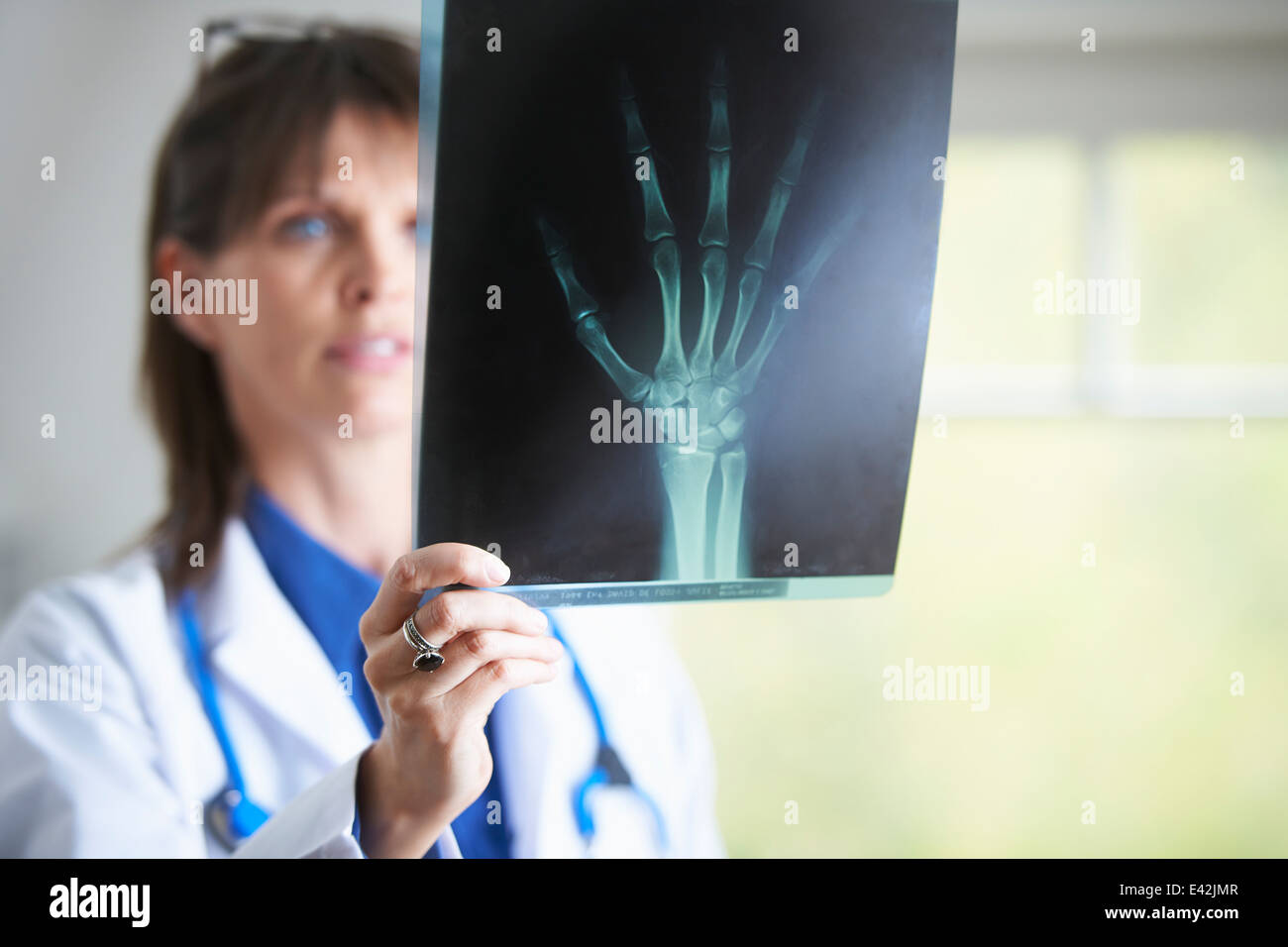 Arzt, die Röntgenaufnahme der Hand betrachten Stockfoto