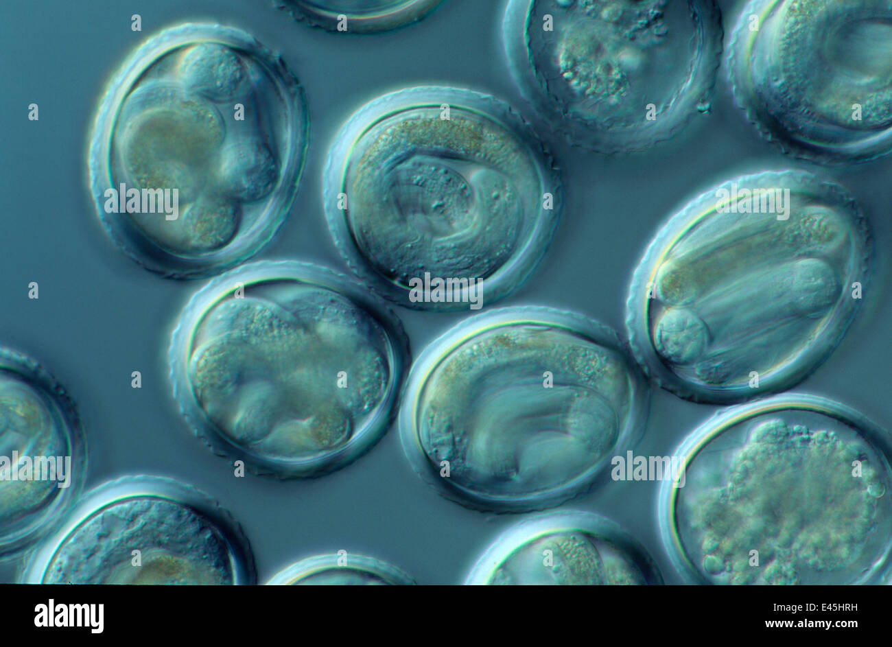 Mikrophotographie voll embryonierten (Neoascaris / Toxocara Vitulorum) Eiern, die unmittelbar vor dem schlüpfen Larven enthalten. Parasitäre Nematoden die Regel infizieren Rinder, gesammelt von ägyptischen Kamele Stockfoto