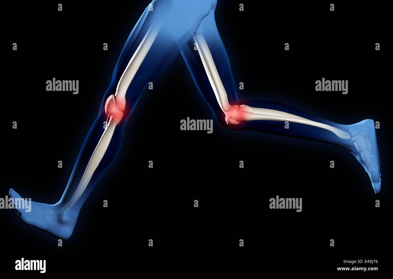 Schmerzen in den Kniegelenken Stockfoto
