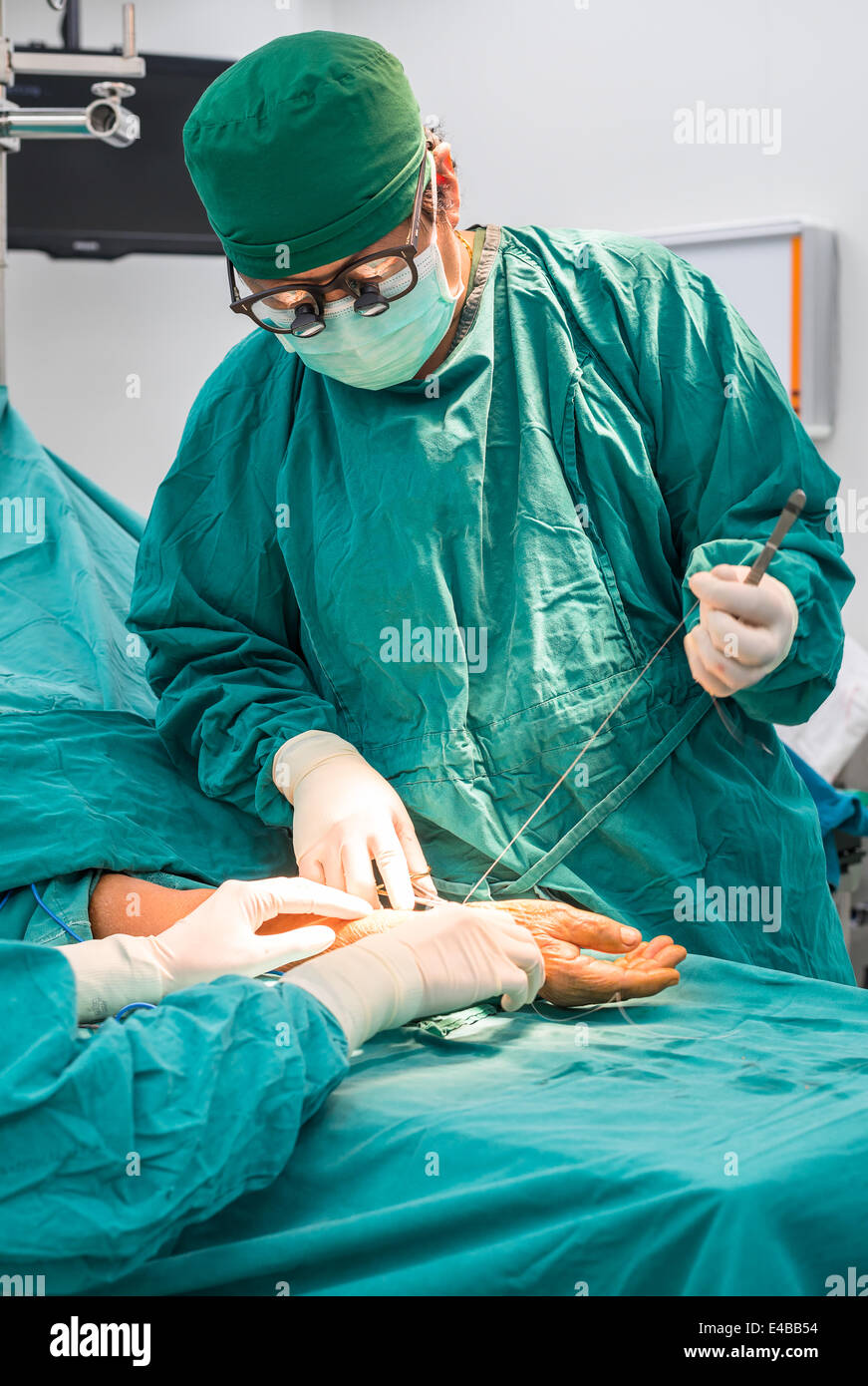 Chirurg arteriovenösen Fistel für langfristige Dialyse für Ende Stadium Nierenkrankheit Patienten in Betrieb Stockfoto