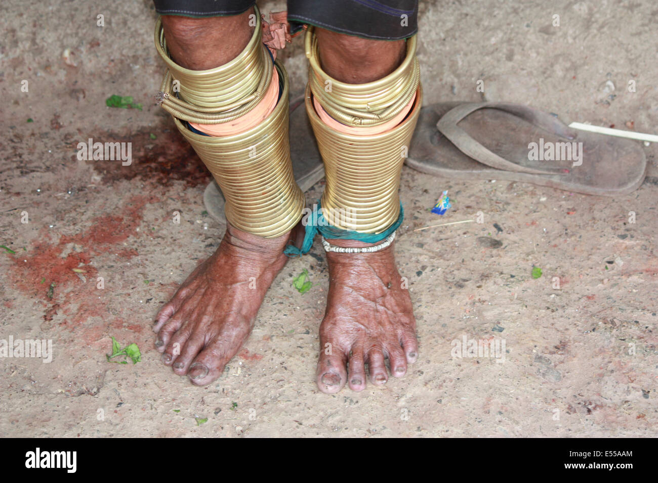 Padaung Frau mit traditionellen Bein Ring, Thailand Stockfoto
