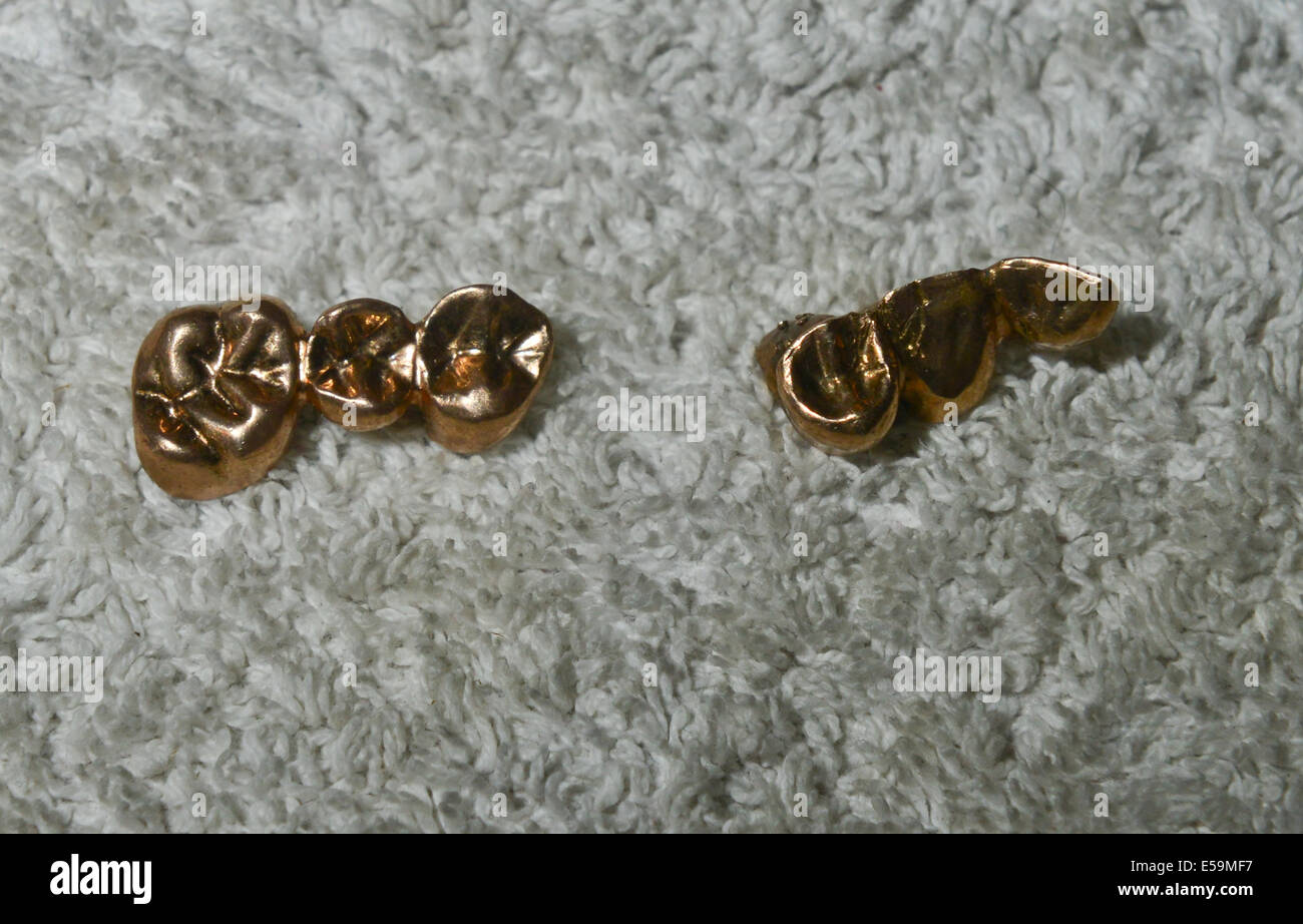 Bild von: Jules Annan Bild zeigt: echtes gold dental Kappen, die von des Nazis jüdische Häftlinge bei ihrer Ankunft in Auschwitz in den Jahren des Holocaust Datum; entfernt wurden 07.07.2014 Stockfoto