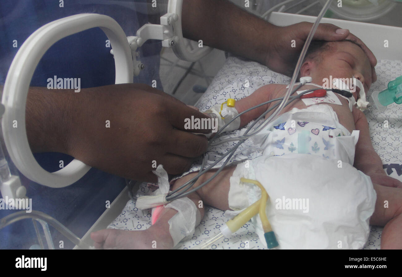 Gaza, Gaza-Streifen Stadt des Khan Younis. 27. Juli 2014. Palästinensischen Babymädchen Shayma Shiekh al-Eid liegt im Inkubator, nachdem Ärzte befreit ihr aus dem Schoß der Mutter, den Sanitäter sagte am 27. Juli 2014 bei einem israelischen Luftangriff in einem Krankenhaus in der südlichen Gazastreifen Stadt des Khan Younis, getötet wurde. Islamischen Hamas-Bewegung am Sonntag kündigte es zugestimmt hat, mit der palästinensischen Gruppierungen, die einen UN-vorgeschlagenen Waffenstillstand für 24 Stunden zu akzeptieren, die beginnt 14:00, 5:00 Uhr GMT am Sonntag im Gaza-Streifen. © Khaled Omar/Xinhua/Alamy Live-Nachrichten Stockfoto