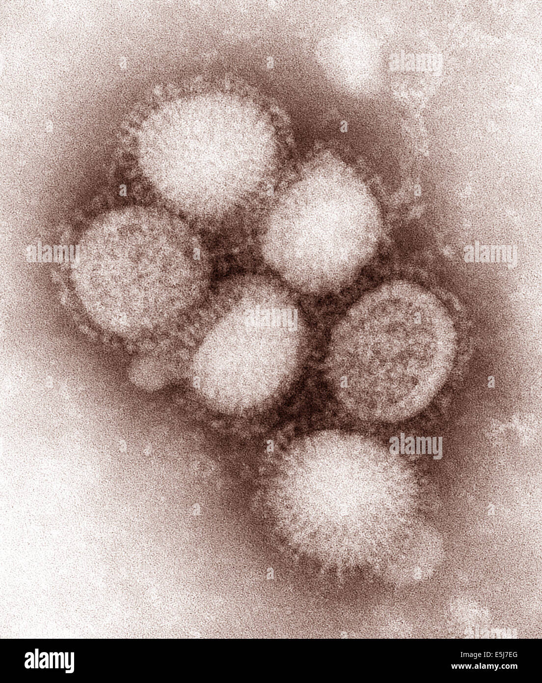 Das H1N1-Virus, das verursacht eine Pandemie ist jetzt eine regelmäßige menschlichen Grippevirus und saisonal weltweit zirkulieren weiterhin. Aus dem Archiv des Pressedienstes Portrait. Stockfoto