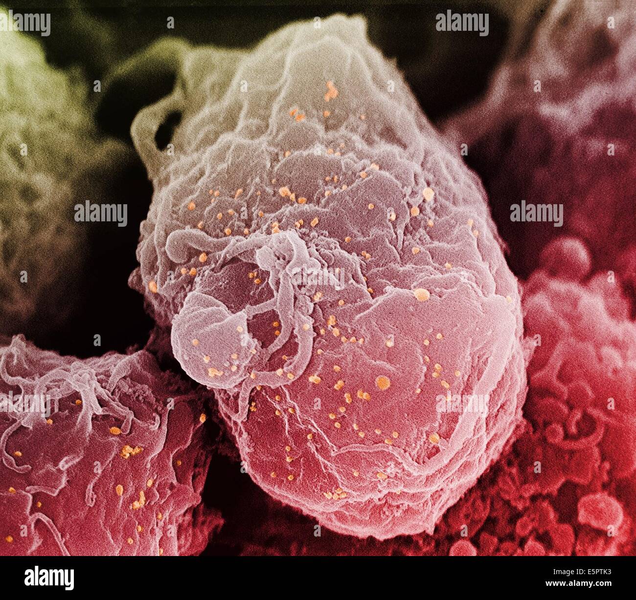 Scanning Electron Schliffbild (SEM) des humanen ImmundefizienzVirus