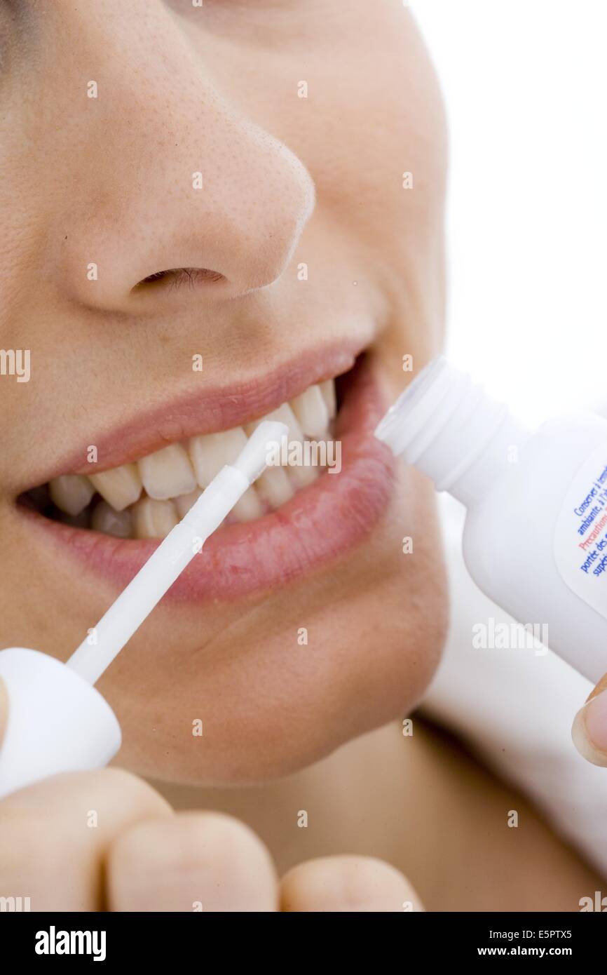 Frau Anwendung eine bleaching-Gel auf den Zähnen. Stockfoto