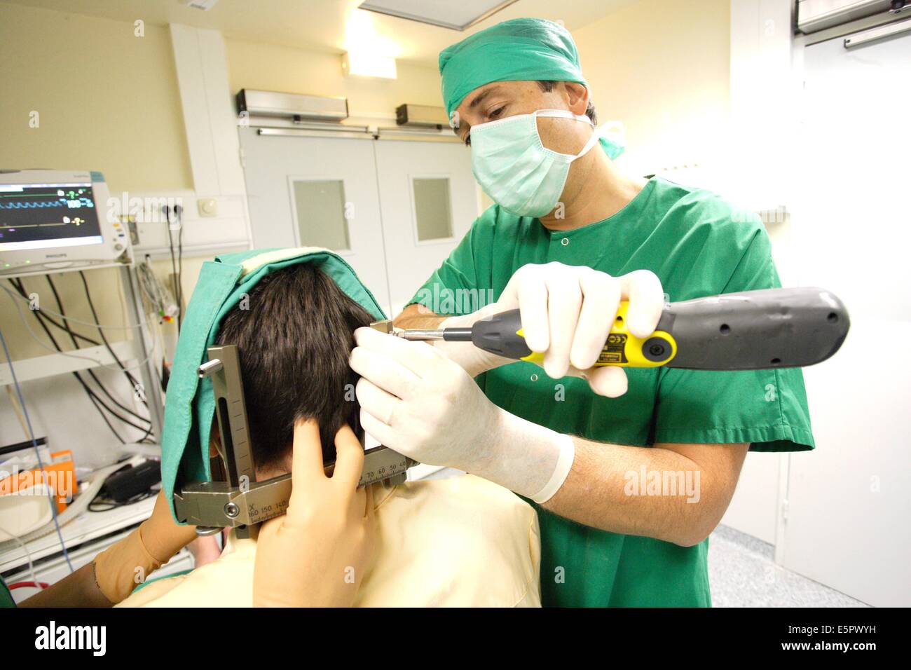 Ein Meningeom (gutartiger Hirntumor) mit einem Gamma Knife Behandlung, ist auf den Kopf des ...